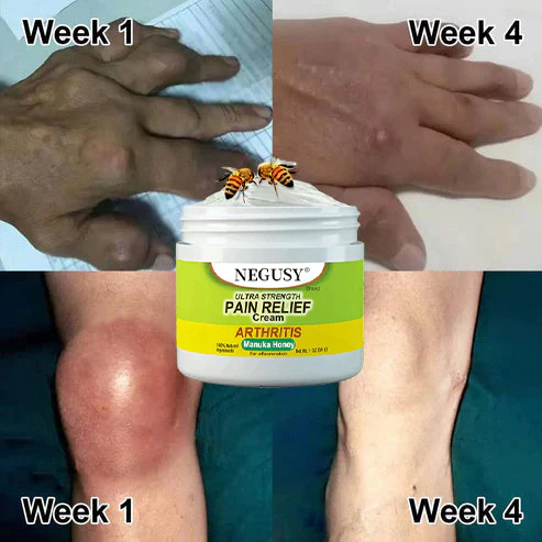 🐝NEGUSY®New Zealand Bee Venom Joint and Bone Therapy Advanced Cream⏳Limited time discount of 80%⏳ - Image 7